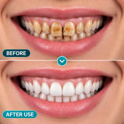 BalanceVie EnamelArc Targeted Enamel Care Gel