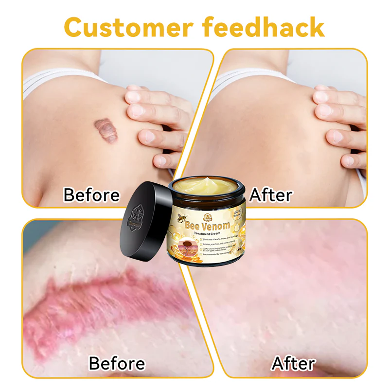 flysmus™ Bee Venom Skin Treatment Cream 🌟(Made in AU)