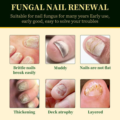 Nail Fungus Solution product image 2