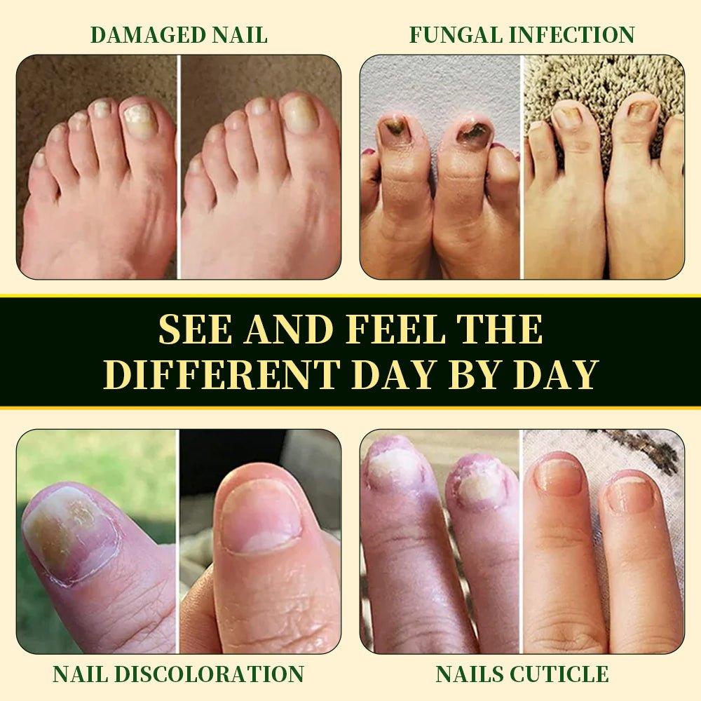 Nail Fungus Solution product image 6