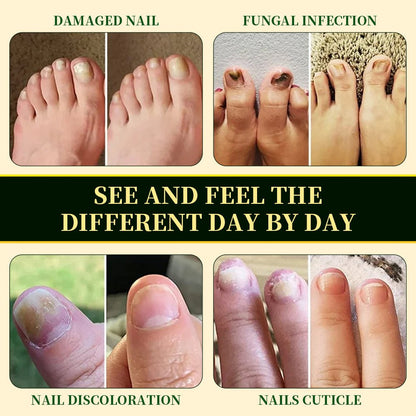 Nail Fungus Solution product image 6
